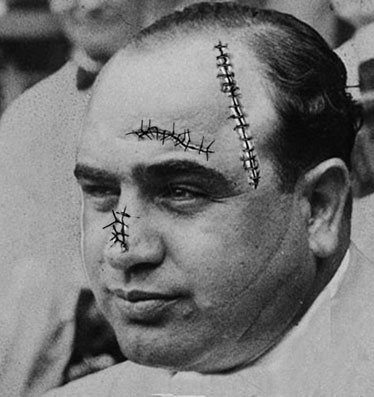 il degente del letto numero 20, Al Capone, Scareface